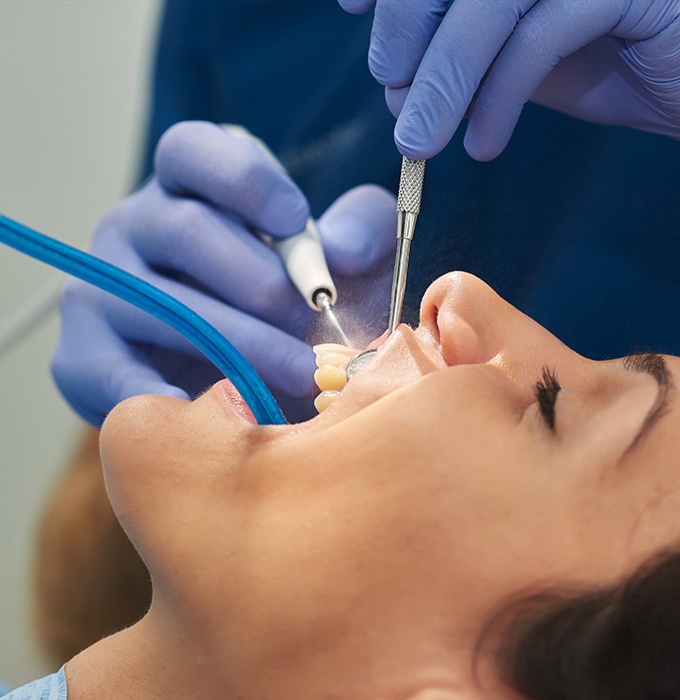 Closeup of woman smiling during dental cleaning